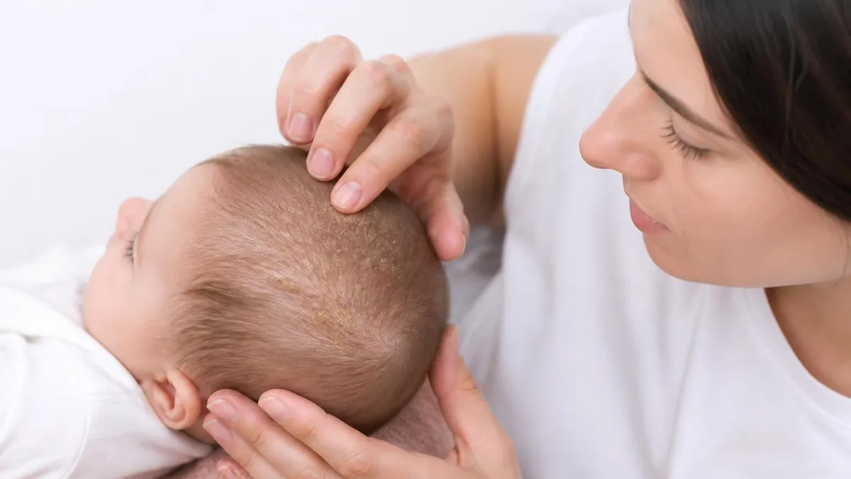 Cradle Cap - CAP - Certified Administrative Professional certification study resource