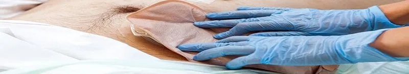 Certified Ostomy Care Nurse - COCN Test study guide