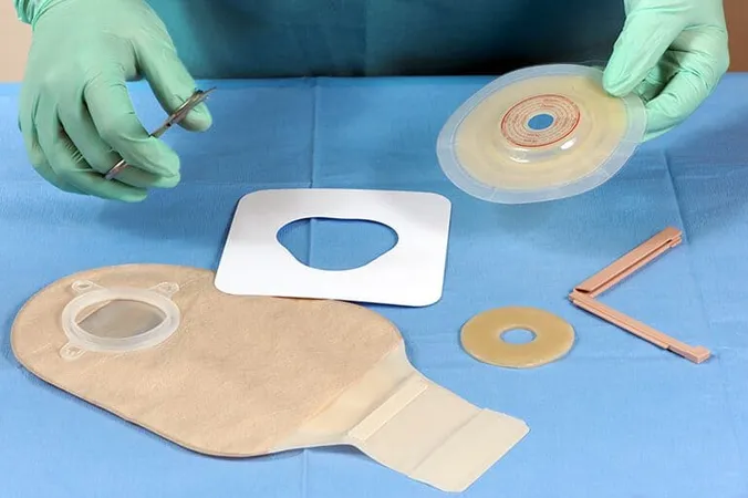 Ostomy Care Nurse - COCN Test study guide