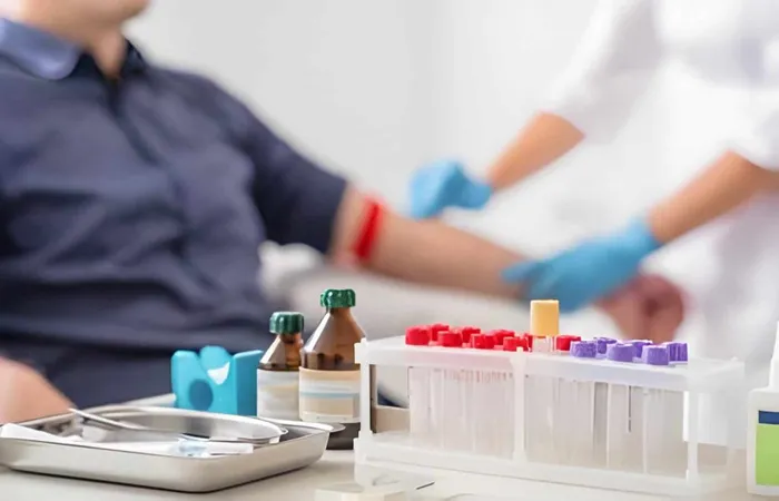 Immune Response Test X - Lymphocyte Stimulation Test study guide