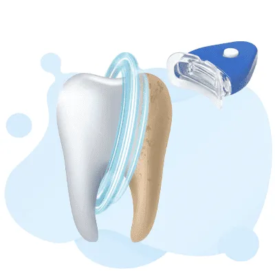Teeth Whitening
