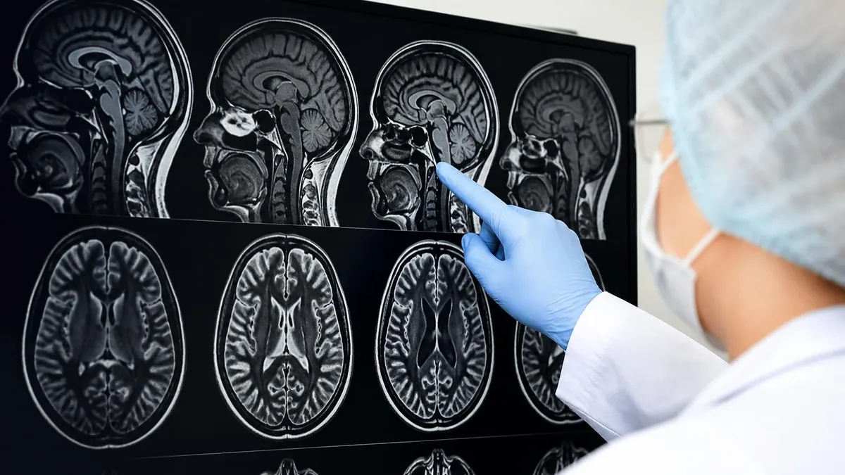 Abnormal Mri Brain Findings by Category - MRI - Magnetic Resonance Imaging certification study resource