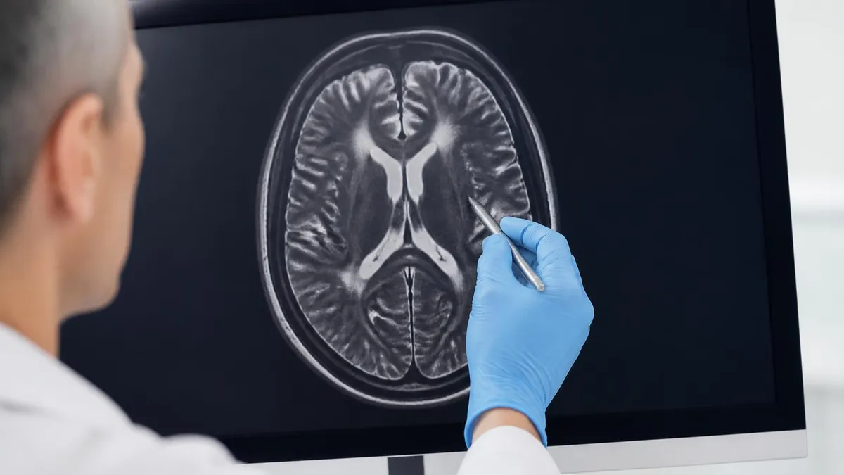 Cardiac Mri in Heart Failure by the Numbers - MRI - Magnetic Resonance Imaging certification study resource