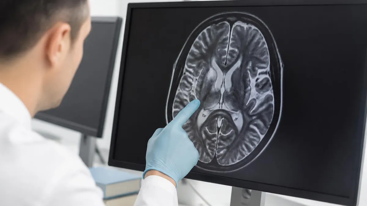 Chiari Mri Quick Reference - MRI - Magnetic Resonance Imaging certification study resource