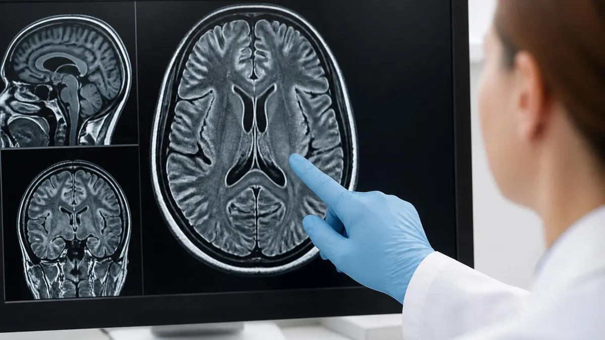 Complete Mri Preparation Checklist - MRI - Magnetic Resonance Imaging certification study resource