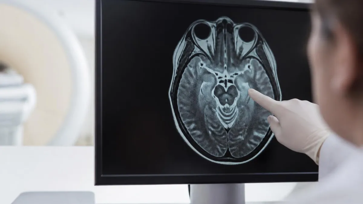 Dedifferentiated Liposarcoma by the Numbers - MRI - Magnetic Resonance Imaging certification study resource