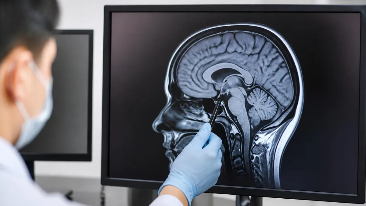Mri and Nerve Damage by the Numbers - MRI - Magnetic Resonance Imaging certification study resource
