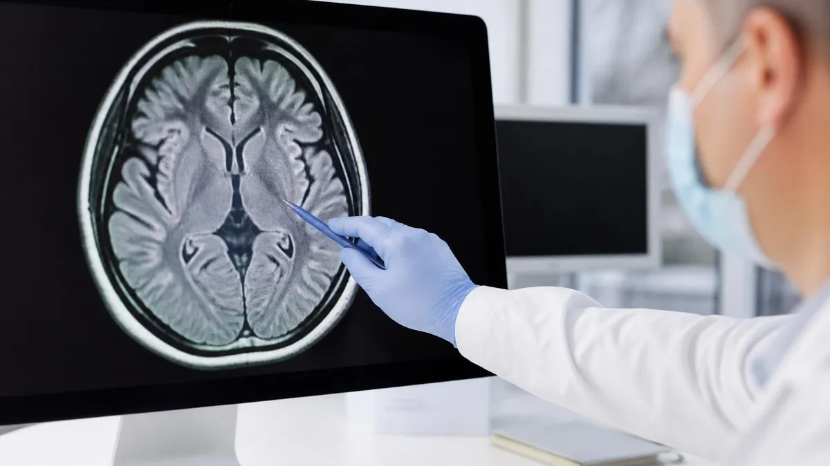 Mri and Alzheimer's by the Numbers - MRI - Magnetic Resonance Imaging certification study resource