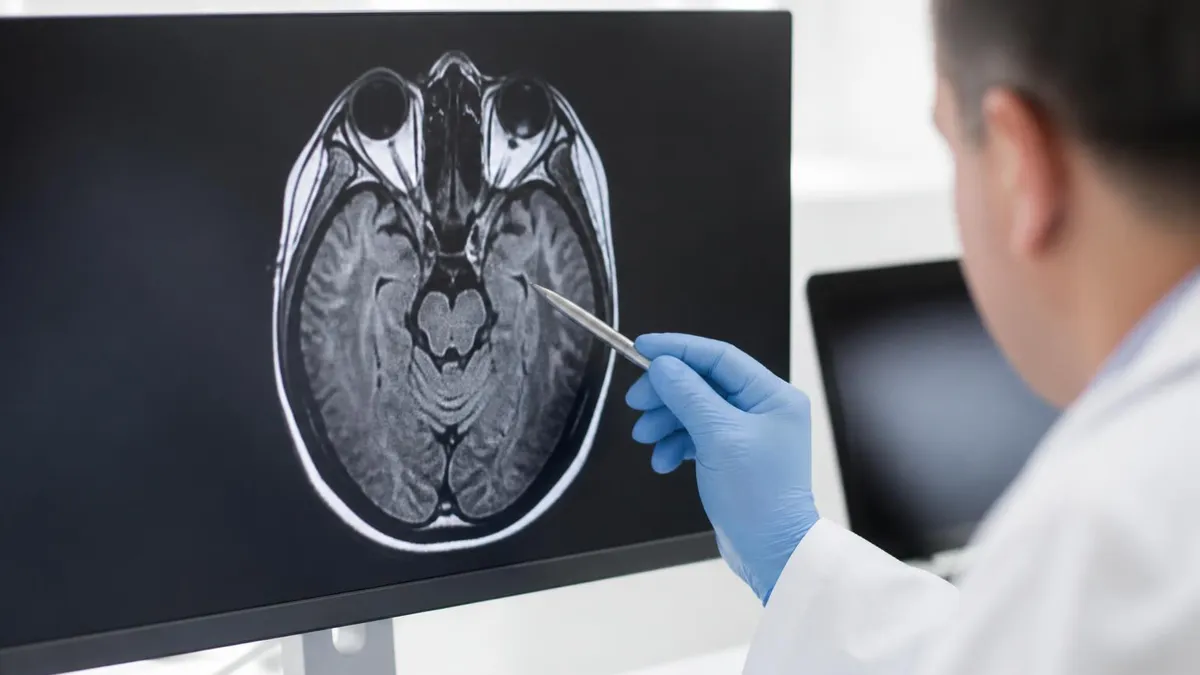 Mri of the Brain at a Glance - MRI - Magnetic Resonance Imaging certification study resource