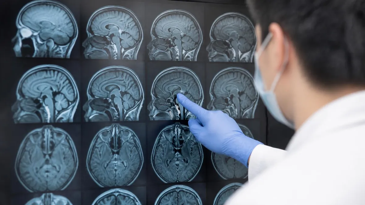 Mri Shoulder Quick Facts - MRI - Magnetic Resonance Imaging certification study resource