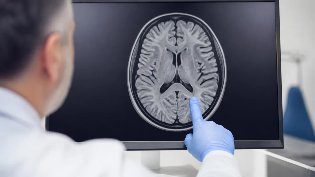 Mri Stir Sequence by the Numbers - MRI - Magnetic Resonance Imaging certification study resource