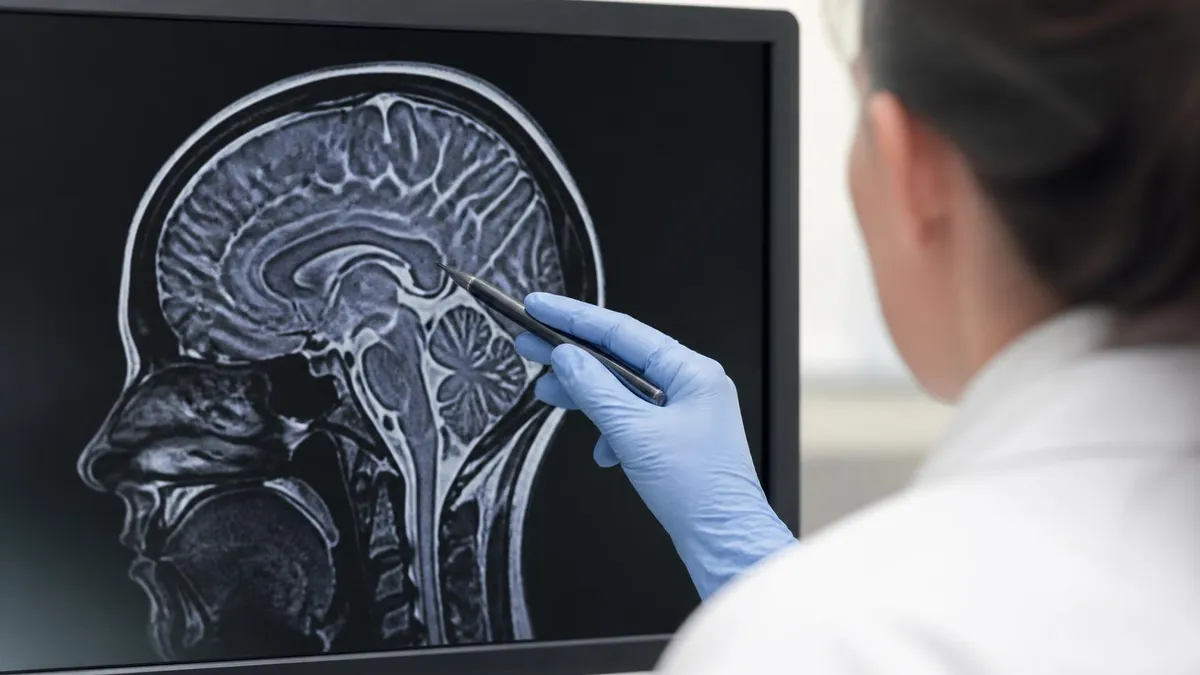 Nephrogenic Systemic Fibrosis (nsf): the Story - MRI - Magnetic Resonance Imaging certification study resource