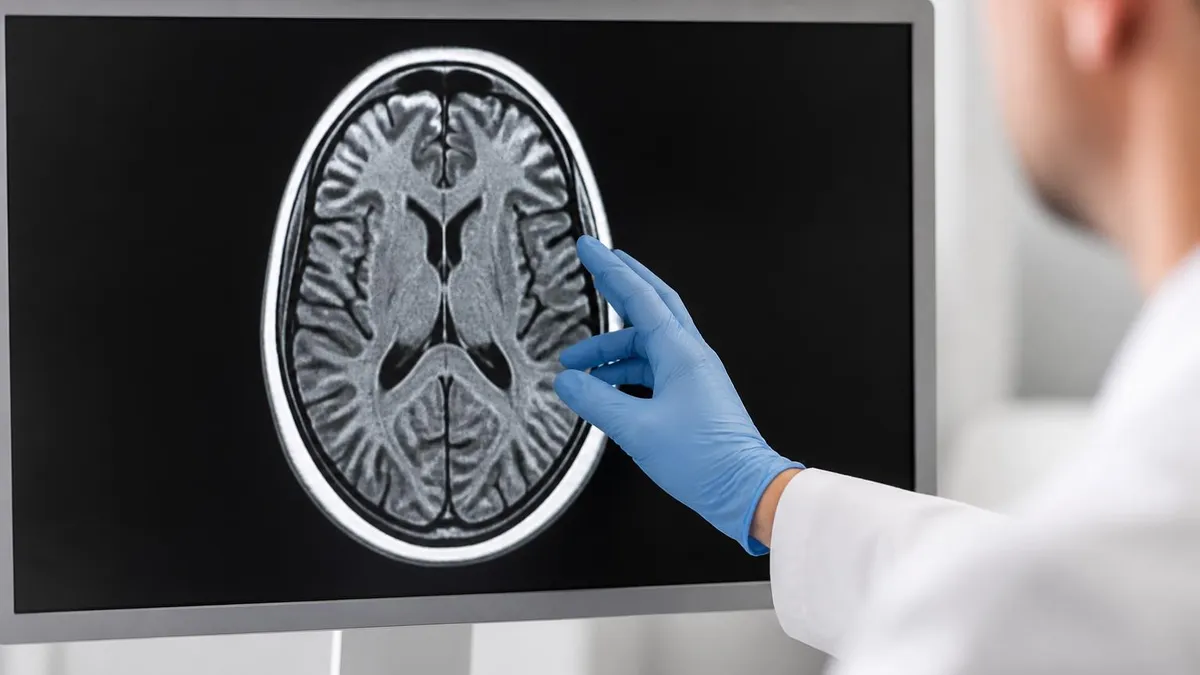 Signal Intensity, Tr, and Te - MRI - Magnetic Resonance Imaging certification study resource