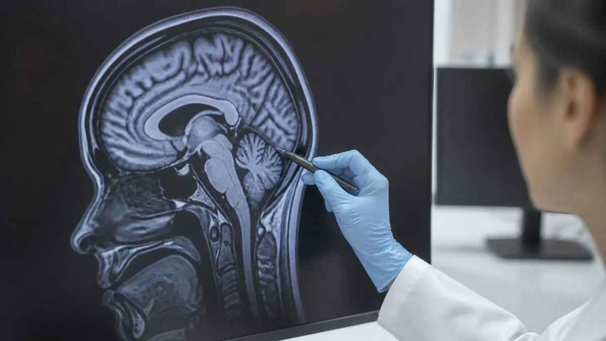 What Causes Mri Accidents: the Projectile Effect - MRI - Magnetic Resonance Imaging certification study resource