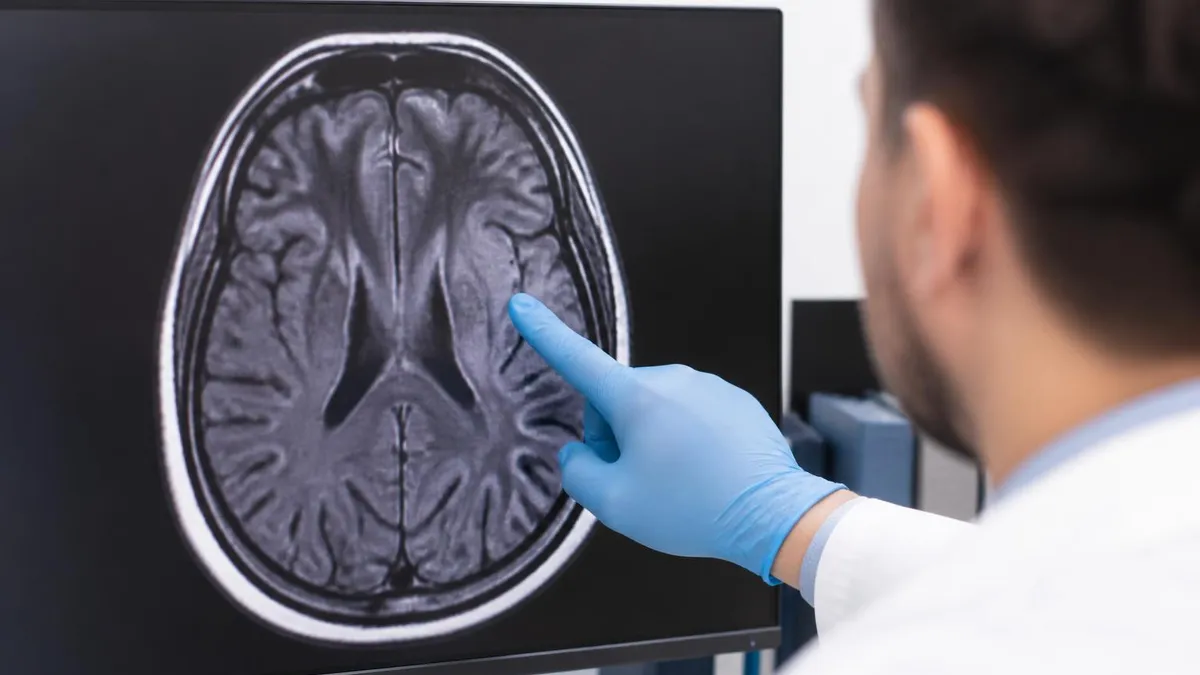What is an Mri Test, Really? - MRI - Magnetic Resonance Imaging certification study resource