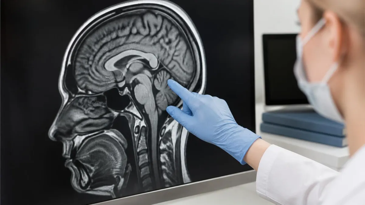 What is an Open Mri? - MRI - Magnetic Resonance Imaging certification study resource