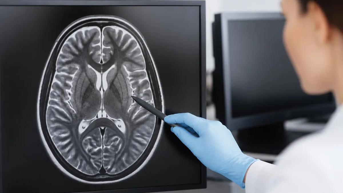 Why Mri Machines Cost So Much - MRI - Magnetic Resonance Imaging certification study resource
