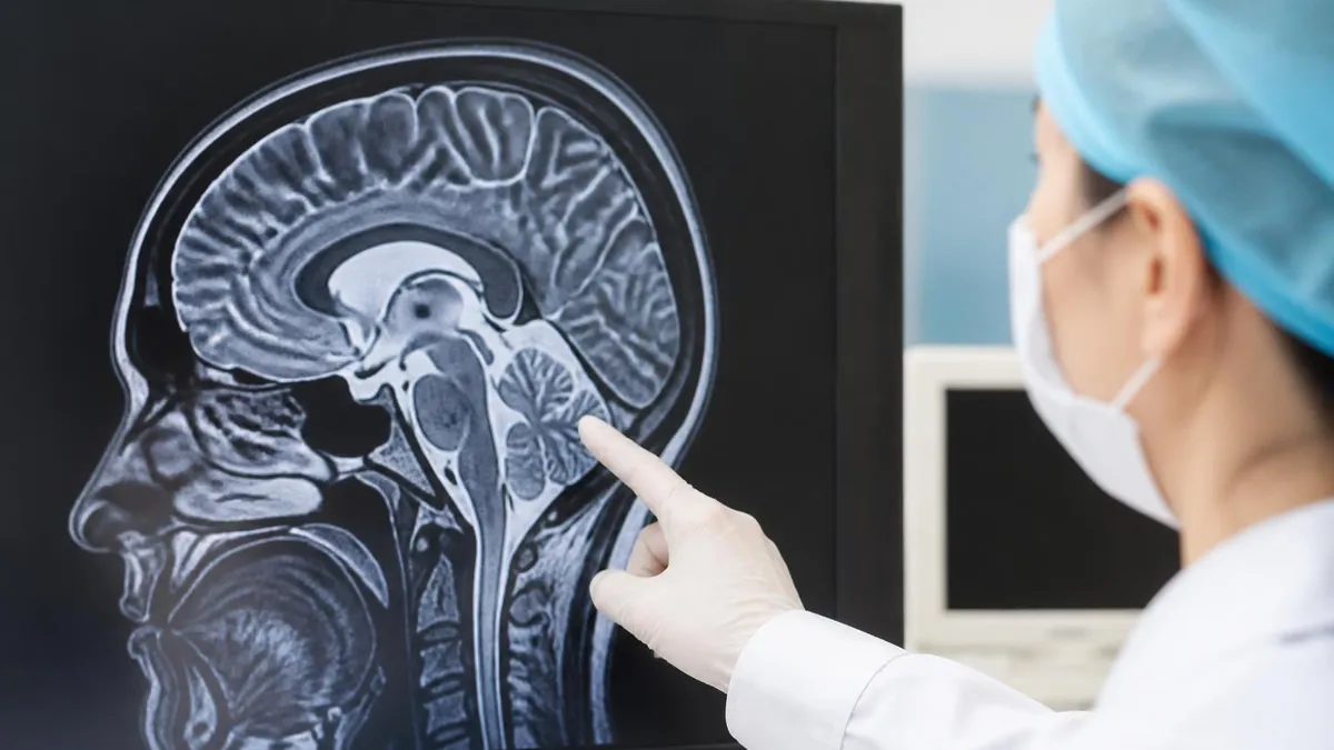 Brain MRI Findings: Understanding Ischemic Changes and Common Abnormalities on MRI