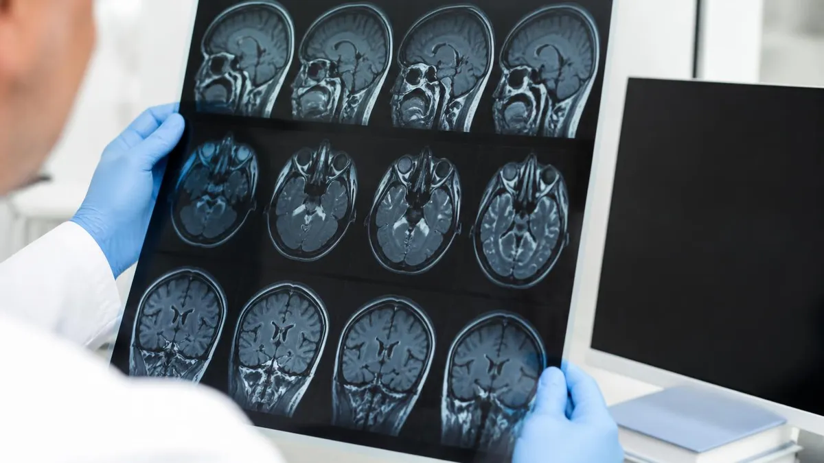 Hand MRI: What It Shows, How It Works, and What to Expect