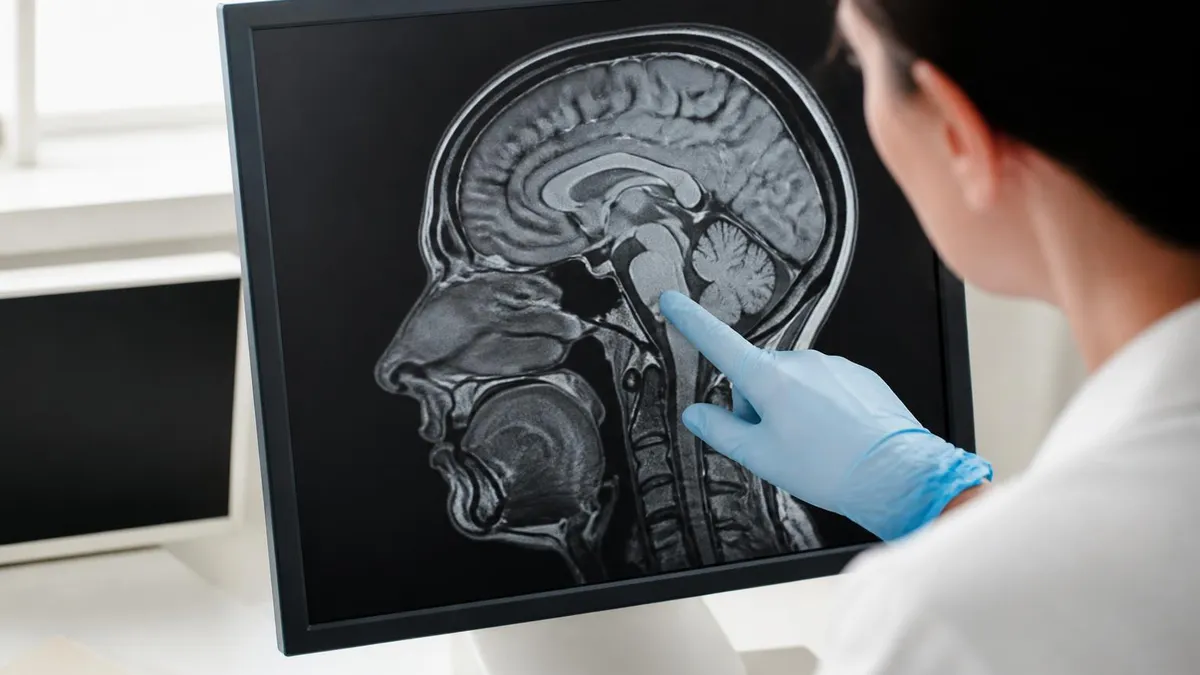 How Often Can You Get an MRI? Safety Guidelines, Frequency Limits, and What Patients Need to Know
