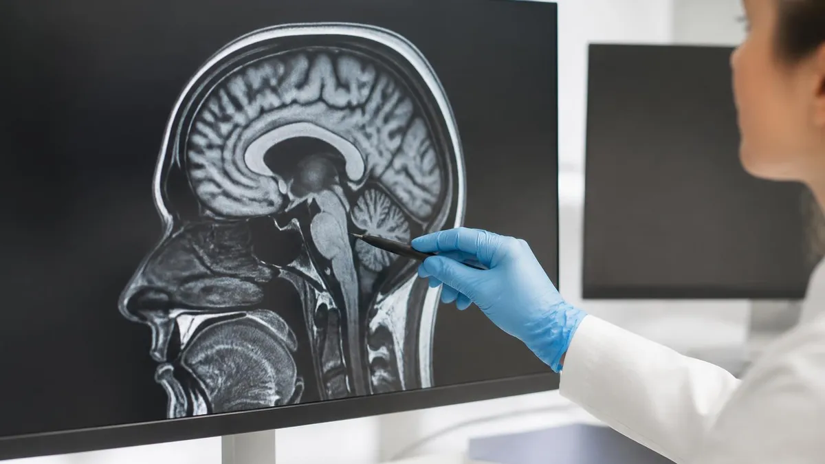 ICD 10 Codes for MRI: Complete Guide to Abnormal MRI Coding, Documentation, and Reimbursement