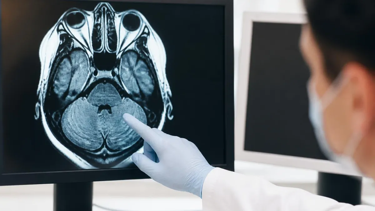 MRI Arthrogram: Complete Guide to Joint Imaging