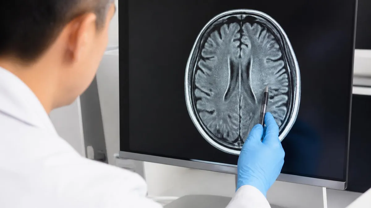 MRI Head Cage: Complete Guide to Head Coils, Function, and Patient Experience