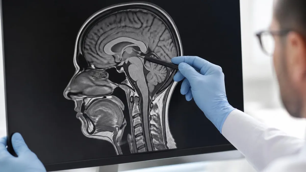 MRI of the Brain With and Without Contrast: Complete 2026 Guide to How It Works, What It Shows, and What to Expect