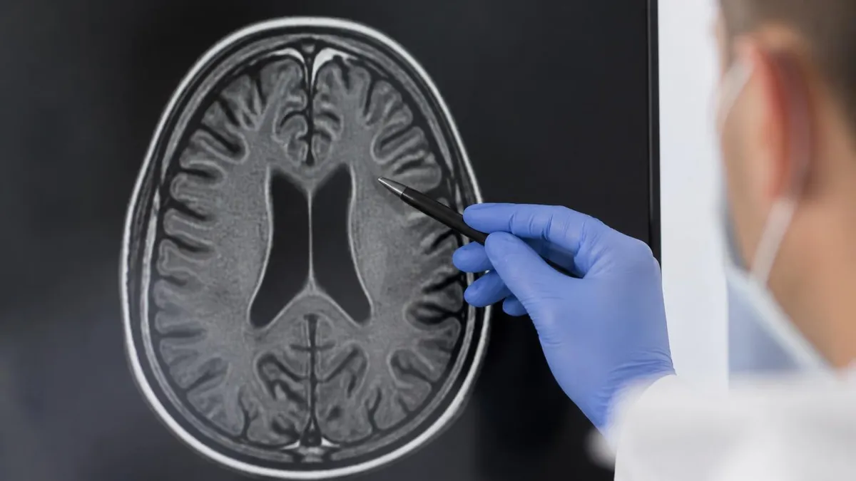 MRI While Pregnant: Safety, Risks, Trimester Guidelines, and What to Expect