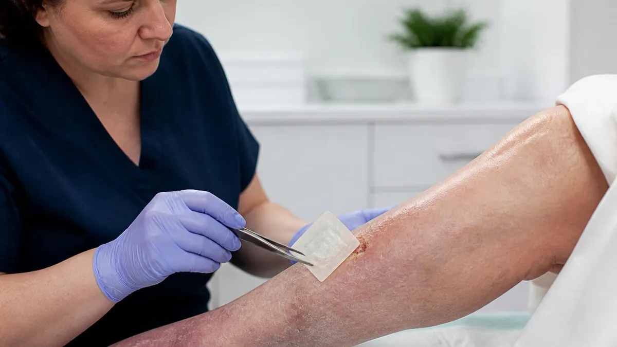 Prisma for Wound Care - Wound Care Certification Exam certification study resource