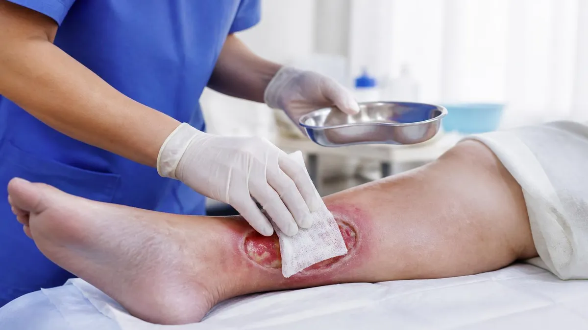 Wet to Dry Wound Care - Wound Care Certification Exam certification study resource