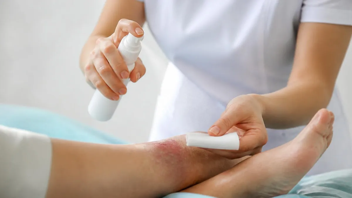 Wound Care Spray - Wound Care Certification Exam certification study resource