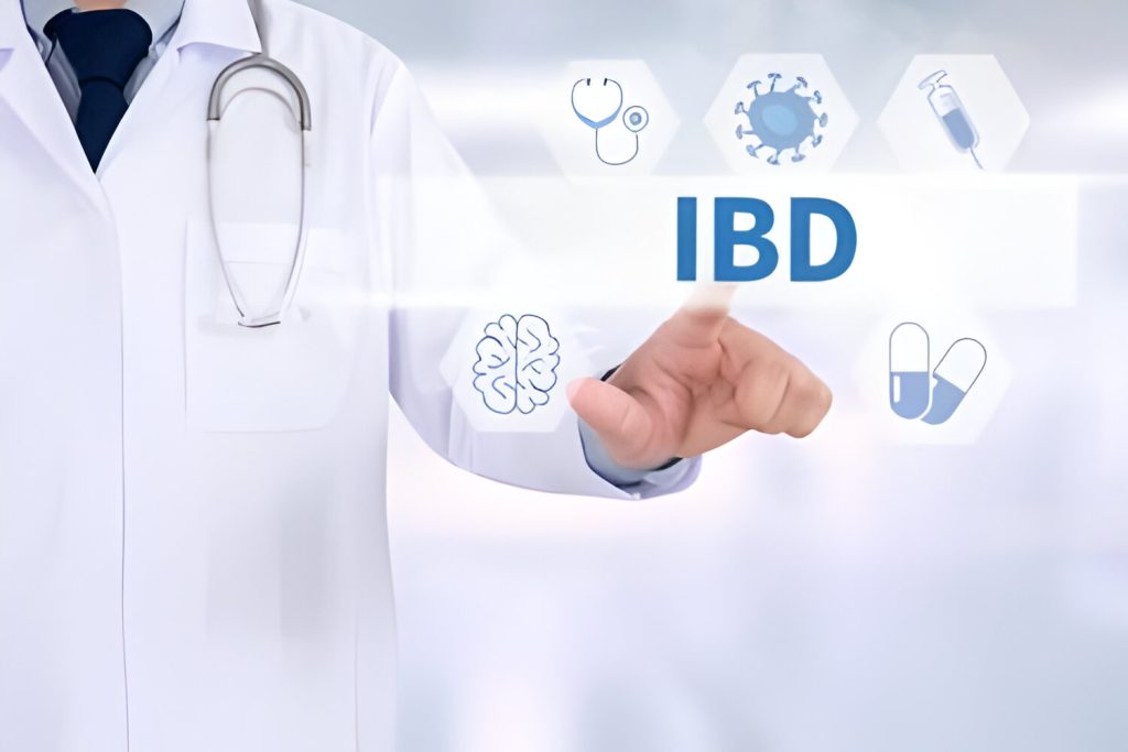 ibd disorder