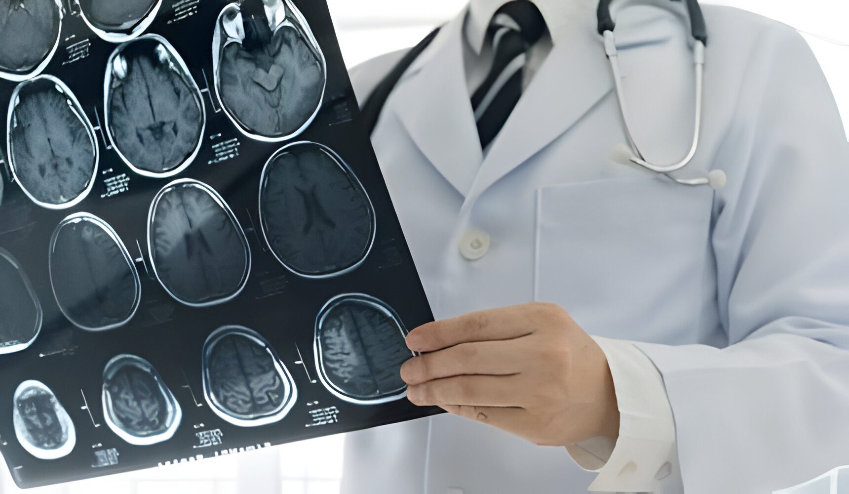 NIHSS (National Institutes of Health Stroke Scale) Test