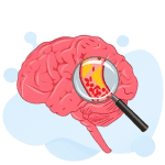 NIHSS (National Institutes of Health Stroke Scale) Test